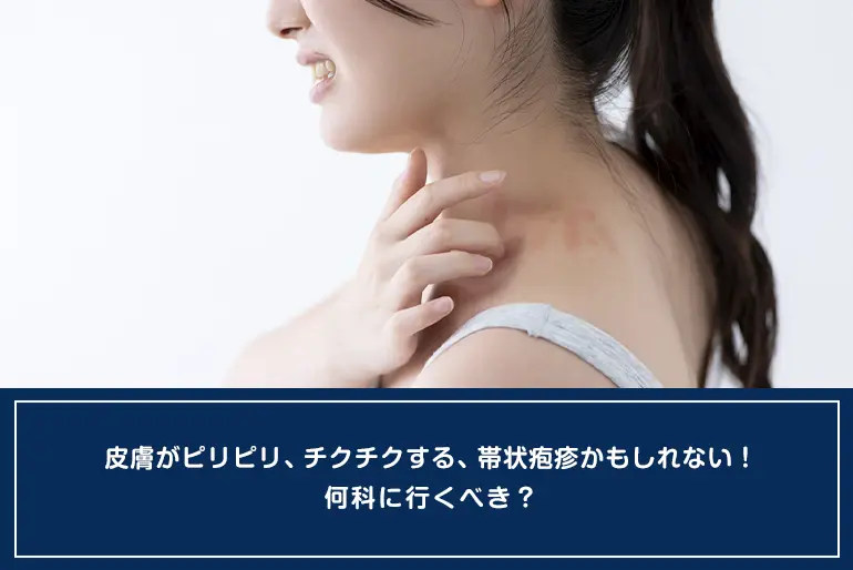皮膚がピリピリ、チクチクする、帯状疱疹かもしれない！何科に行くべき？のイメージ