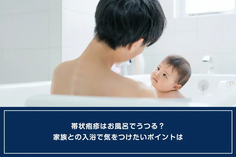 帯状疱疹はお風呂でうつる？家族との入浴で気をつけたいポイントはのイメージ