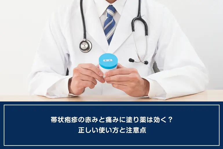 帯状疱疹の赤みと痛みに塗り薬は効く？正しい使い方と注意点のイメージ