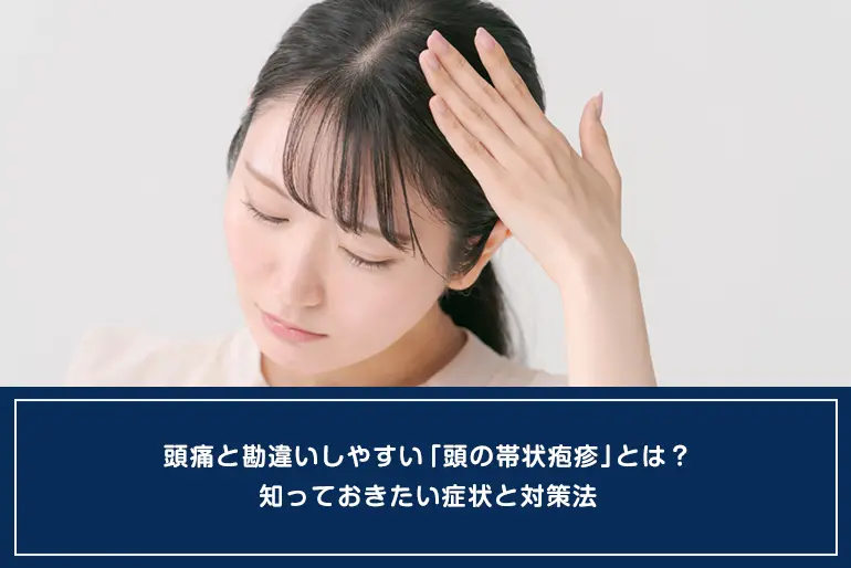 頭痛と勘違いしやすい「頭の帯状疱疹」とは？知っておきたい症状と対策法のイメージ