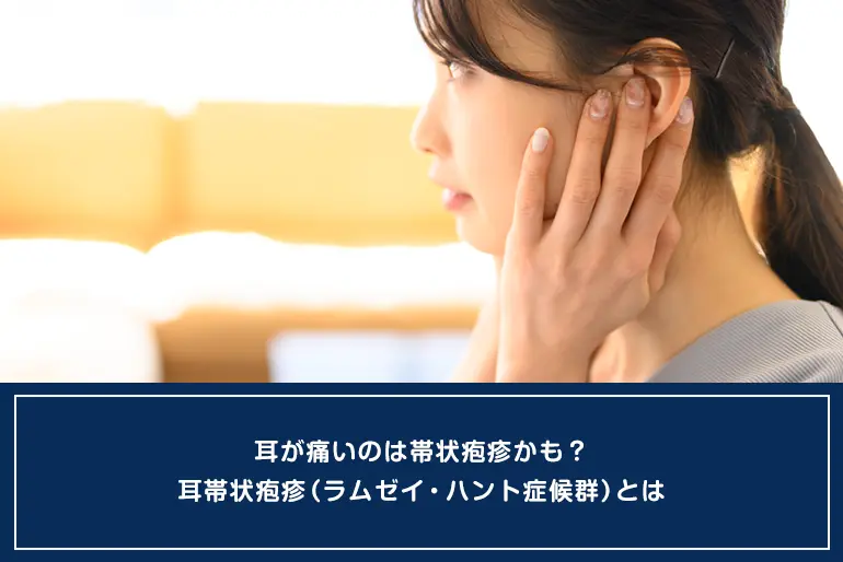 耳が痛いのは帯状疱疹かも？耳帯状疱疹（ラムゼイ・ハント症候群）とはのイメージ