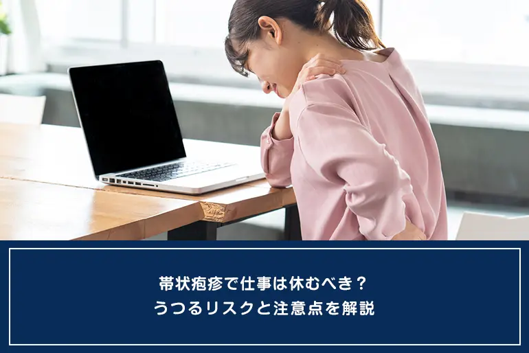 帯状疱疹で仕事は休むべき？うつるリスクと注意点を解説のイメージ