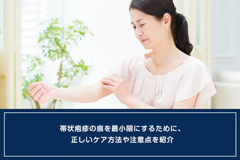 帯状疱疹の痕を最小限にするために、正しいケア方法や注意点を紹介のイメージ