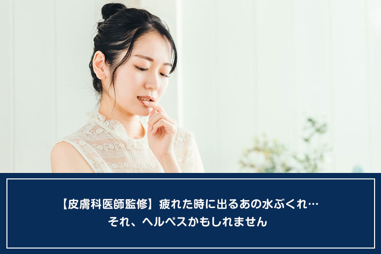 【皮膚科医師監修】疲れた時に出るあの水ぶくれ…それ、ヘルペスかもしれませんのイメージ