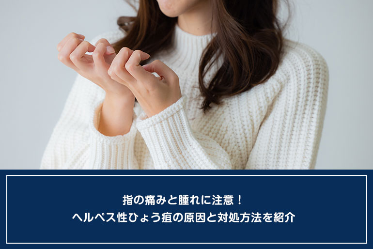 指の痛みと腫れに注意！ヘルペス性ひょう疽の原因と対処方法を紹介のイメージ