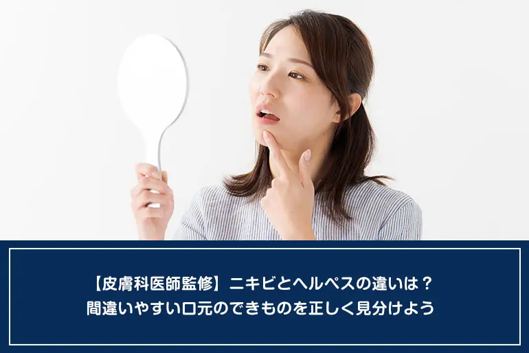 【皮膚科医師監修】ニキビとヘルペスの違いは？間違いやすい口元のできものを正しく見分けようのイメージ