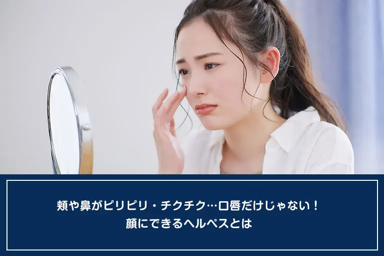 頬や鼻がピリピリ・チクチク…口唇だけじゃない！顔にできるヘルペスとはのイメージ