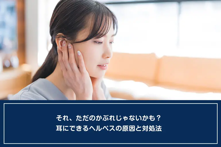 それ、ただのかぶれじゃないかも？耳にできるヘルペスの原因と対処法のイメージ