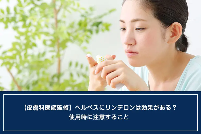 【皮膚科医師監修】ヘルペスにリンデロンは効果がある？使用時に注意することのイメージ