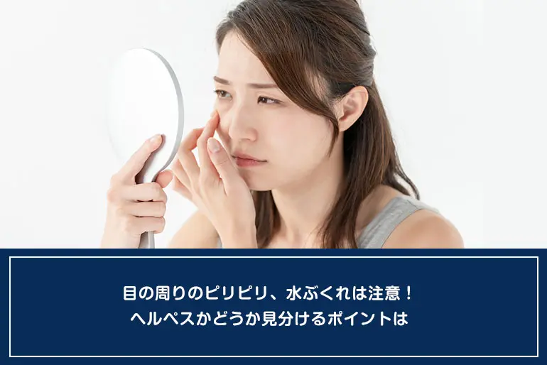 目の周りのピリピリ、水ぶくれは注意！ヘルペスかどうか見分けるポイントはのイメージ