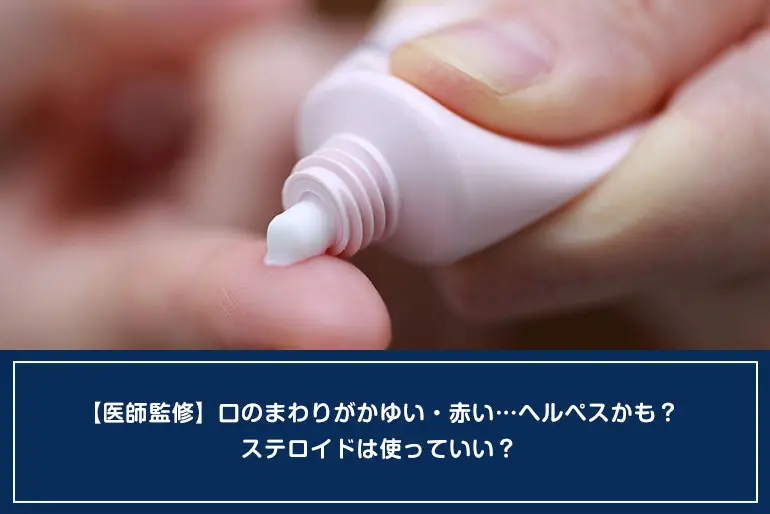 【医師監修】口のまわりがかゆい・赤い…ヘルペスかも？ステロイドは使っていい？のイメージ