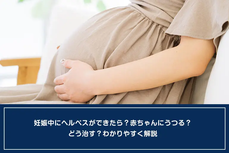 妊娠中にヘルペスができたら？赤ちゃんにうつる？どう治す？わかりやすく解説のイメージ