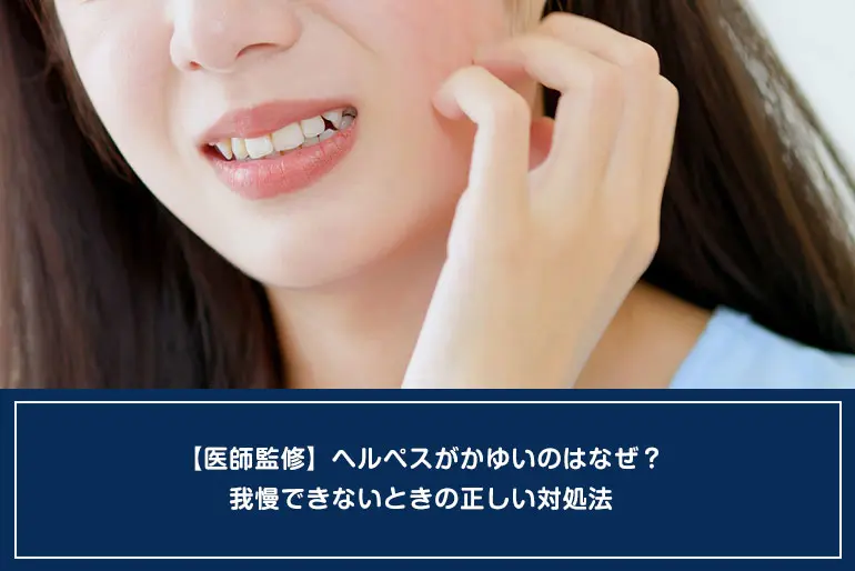 【医師監修】ヘルペスがかゆいのはなぜ？我慢できないときの正しい対処法のイメージ