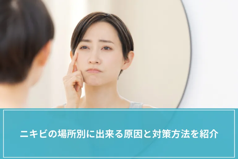 ニキビの場所別に出来る原因と対策方法を紹介【医師監修】