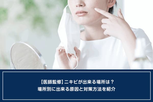 【医師監修】ニキビが出来る場所は？場所別に出来る原因と対策方法を紹介のイメージ