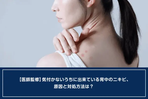 【医師監修】気付かないうちに出来ている背中のニキビ、原因と対処方法は？のイメージ