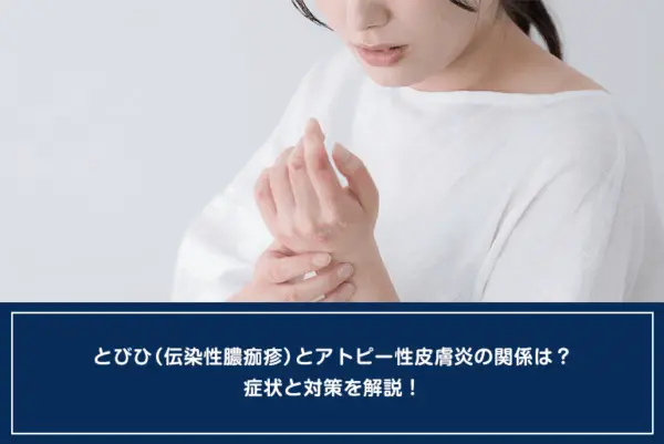 とびひ（伝染性膿痂疹）とアトピー性皮膚炎の関係は？症状と対策を解説！のイメージ