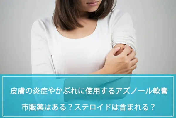 アズノール軟膏に市販薬はある？ステロイドは含まれる？ 成分や効果効能について解説のイメージ