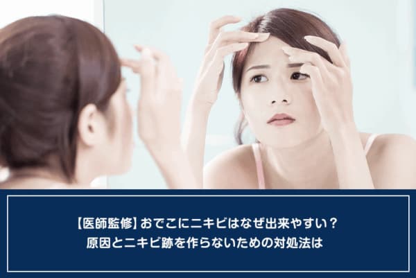 【医師監修】おでこにニキビはなぜ出来やすい？原因とニキビ跡を作らないための対処法はのイメージ
