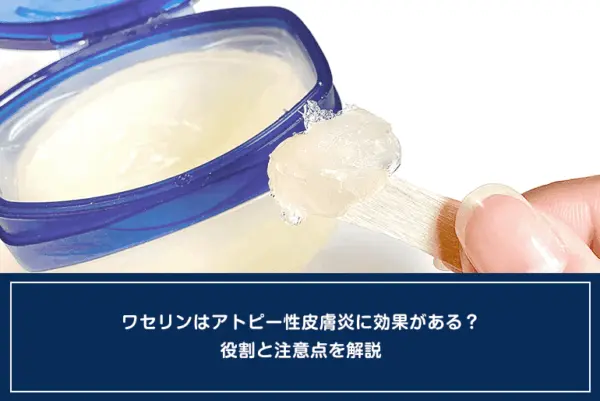 ワセリンはアトピー性皮膚炎に効果がある？役割と注意点を解説のイメージ
