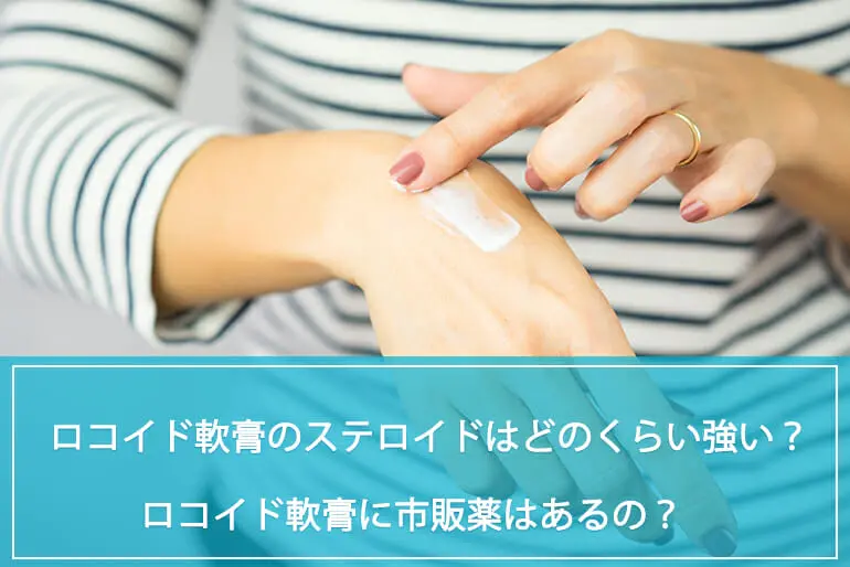 ロコイド軟膏0.1%（ヒドロコルチゾン）に含まれる成分ステロイドの強さは？市販薬はあるの？副作用や購入場所まで詳しく解説！のイメージ